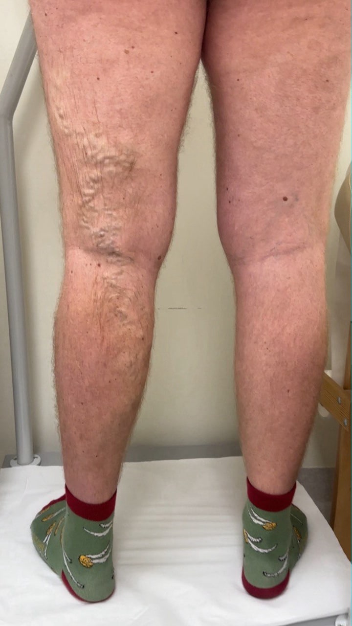 <span class="bt_bb_before_after_image_before_text">До</span>